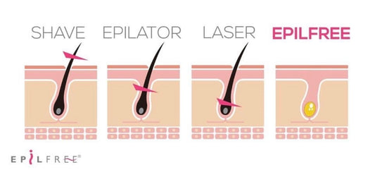 Epilfree Sugaring - Half arm