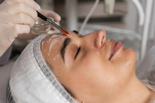 Facial Peel